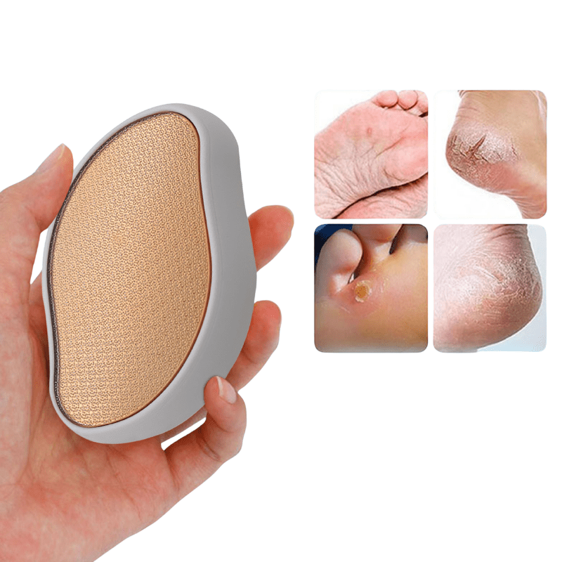 Hand håller den ergonomiska fotfilen, bredvid bilder på hård hud och spruckna hälar