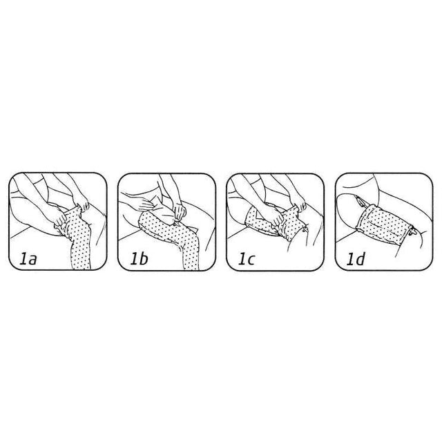 Steg-för-steg illustrationer som visar hur urinpåshållaren Curion Fixette fästs på övre delen av benet