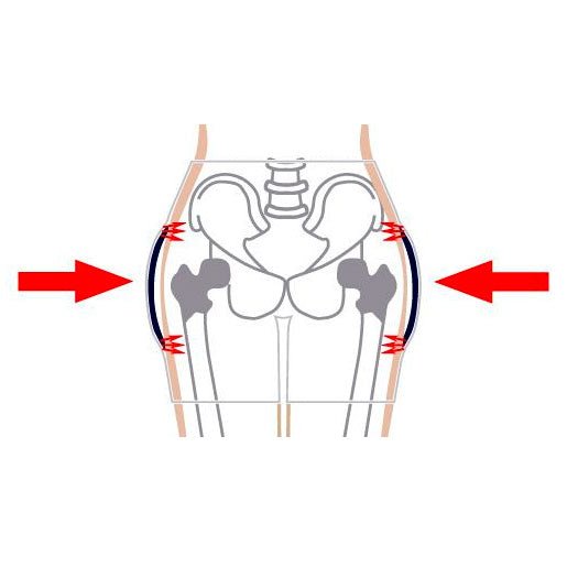 Anatomisk illustration som visar hur höftskyddet skyddar höfterna med röda pilar som indikerar tryck