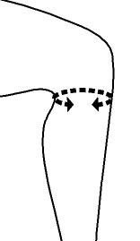 Knäskydd med sidoskenor