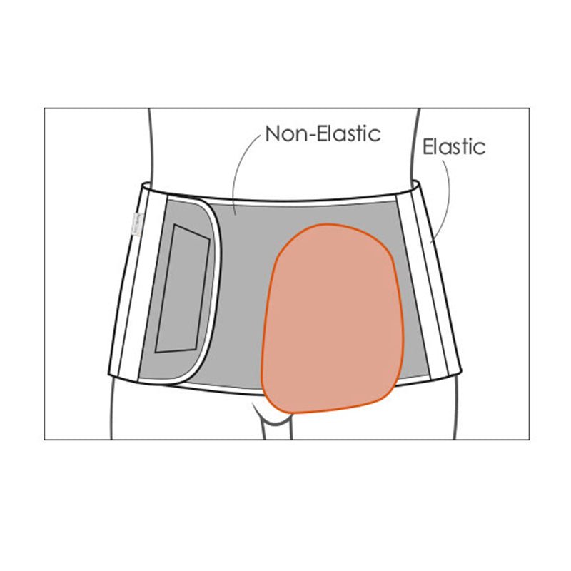 Diagram av stomibältet som visar den oelastiska delen för stomin och den elastiska delen