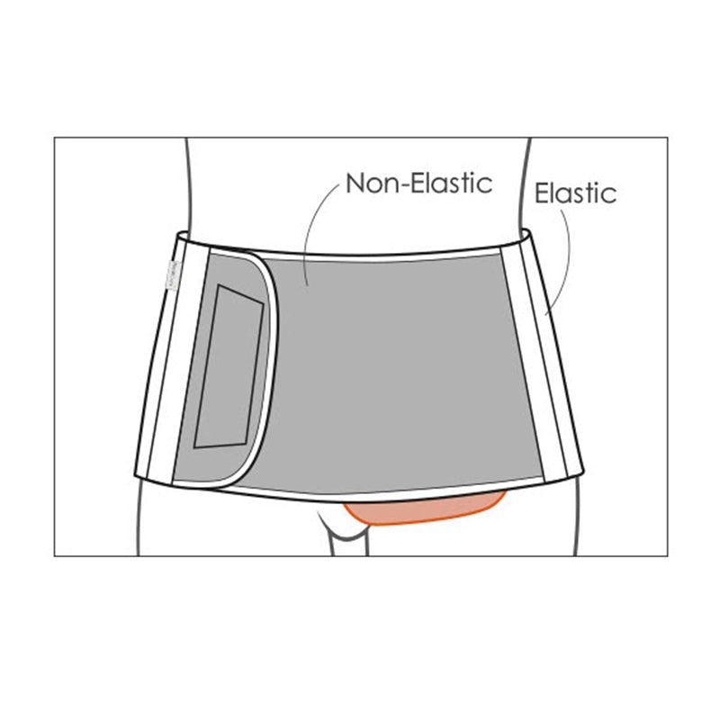 Diagram av stomibältet med oelastisk del och elastisk del, visar mindre stomiplacering