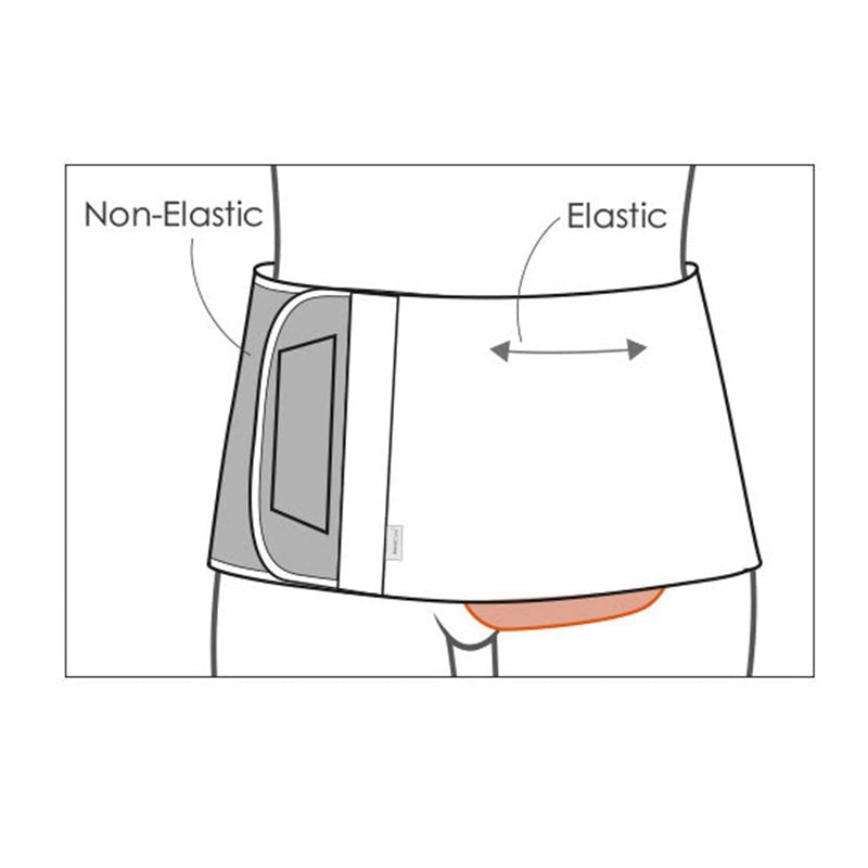 Diagram av stomibältet som illustrerar den oelastiska delen och den elastiska delens sträckförmåga